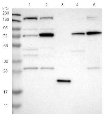 All lanes : Anti-DNAJC14 antibody (ab121535) at 1/250 dilutionLane 1 : RT 4 cell lysateLane 2 : U 251 MG cell lysateLane 3 : Human Plasma lysateLane 4 : Human liver tissue lysateLane 5 : Human tonsil tissue lysate
