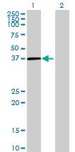 All lanes : Anti-DNAJC18 antibody (ab72689) at 1/500 dilutionLane 1 : DNAJC18 transfected 293T cell lysateLane 2 : Non transfected 293T cell lysateLysates/proteins at 25 µg per lane.SecondaryGoat Anti-Mouse IgG (H&L)-HRP Conjugate at 1/2500 dilution