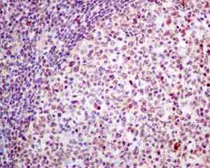 Immunohistochemical analysis of paraffin embedded Human tonsil tissue labeling DNAJC9 with ab166612 antibody at 1/100.