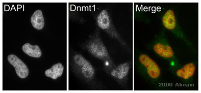 ab19905 at a 1/200 dilution staining paraformaldehyde fixed asynchronous HeLa cells by ICC/IF. The antibody was incubated with the cells for 30 minutes and then bound antibody was detected using a Cy3 conjugated goat anti-rabbit antibody. Nuclei were visualised using DAPI staining. Ab19905 gives a pattern that is predominantly enriched within nuclei. This image is courtesy of an Abreview submitted by Kirk McManus.See Abreview