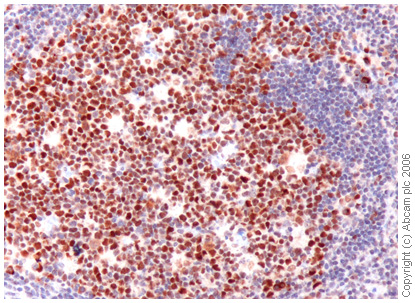 Staining of human tonsil tissue was performed using ab19905. Strong nuclear staining was observed in germinal center cells and scattered cells in the interfollicular area. T cells were weakly to moderately positive and endothelial cells were positive.