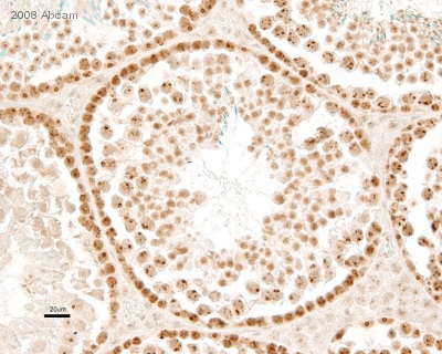 ab19905 (1/100) staining Dnmt1 in paraffin-embbeded mouse testis tissue sections. Tissue underwent fixation in formaldehyde, heat-mediated antigen retrieval in 10mM citrate buffer pH 6.0 and blocking (30 minutes, 8% milk). A biotinylated anti-rabbit IgG (H+L) antibody was used as the secondary. For further experimental details please refer to abreview.See Abreview