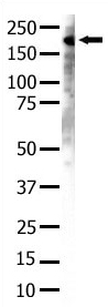 ab4870 used in Western blot to detect Dnmt1 in Jurkat cell lysate.