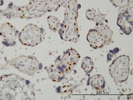 Dnmt1 antibody (ab54759) used in immunohistochemistry at 1ug/ml on formalin fixed and paraffin embedded human placenta.