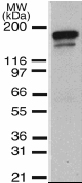 Anti-Dnmt1 antibody [60B1220.1] - ChIP Grade (ab13537) at 1/1000 dilution + 0.1ug mouse recombinant protein. Additional lower band is probably degraded or in other ways modified Dnmt1. 