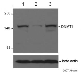 All lanes : Anti-Dnmt1 antibody [60B1220.1] - ChIP Grade (ab13537) at 1 µg/mlLane 1 : HCT116 whole cell lysateLane 2 : HCT116 DNMT1 KO whole cell lysateLane 3 : HCT116 DNMT3b KO whole cell lysateSecondaryHRP conjugated Sheep anti-mouse IgGdeveloped using the ECL techniquePerformed under reducing conditions.