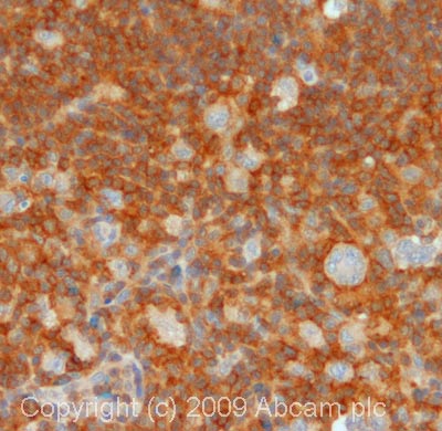 IHC image of ab74659 staining in human lymph node formalin fixed paraffin embedded tissue section, performed on a Leica BondTM system using the standard protocol F. The section was pre-treated using heat mediated antigen retrieval with sodium citrate buffer (pH6, epitope retrieval solution 1) for 20 mins. The section was then incubated with ab74659, 5µg/ml, for 15 mins at room temperature and detected using an HRP conjugated compact polymer system. DAB was used as the chromogen. The section was then counterstained with haematoxylin and mounted with DPX. For other IHC staining systems (automated and non-automated) customers should optimize variable parameters such as antigen retrieval conditions, primary antibody concentration and antibody incubation times.