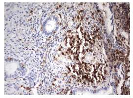 Immunohistochemical analysis of paraffin-embedded Human endometrium tissue labeling DOCK2 with ab180405 at 1/150 dilution.