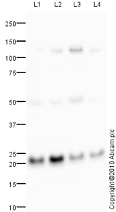 All lanes : Anti-COPS8 antibody (ab77300) at 1 µg/mlLane 1 : HepG2 (Human hepatocellular liver carcinoma cell line) Whole Cell LysateLane 2 : SHSY-5Y (Human neuroblastoma cell line) Whole Cell LysateLane 3 : Saos 2 (Human epithelial-like osteosarcoma cell line) Whole Cell LysateLane 4 : Brain (Human) Tissue Lysate - adult normal tissue (ab29466)Lysates/proteins at 10 µg per lane.SecondaryGoat polyclonal to Rabbit IgG - H&L - Pre-Adsorbed (HRP) at 1/3000 dilutiondeveloped using the ECL techniquePerformed under reducing conditions.