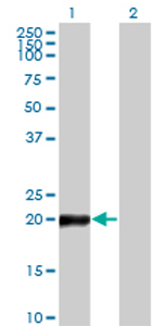 All lanes : Anti-COPS8 antibody (ab77462) at 1/500 dilutionLane 1 : COPS8 transfected 293T cell lysateLane 2 : Non transfected 293T cell lysateLysates/proteins at 25 µg per lane.SecondaryGoat anti-mouse IgG (H&L)-HRP conjugate at 1/2500 dilution