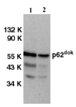 All lanes : Anti-DOK1 antibody (ab8112) at 1 µg/mlLane 1 : Jurkat cell lysatesLane 2 : THP-1 cell lysateObserved band size : 62 kDa (why is the actual band size different from the predicted?)