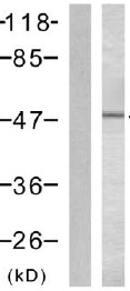 All lanes : Anti-DOK2 (phospho Y299) antibody (ab47376) at 1/500 dilutionLane 1 : Untreated extracts from K562 cellsLane 2 : Extracts from K562 cells, treated with Starvation