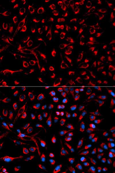 Immunocytochemistry/Immunofluorescence analysis of HeLa cells using ab175624. Blue DAPI for nuclear staining.