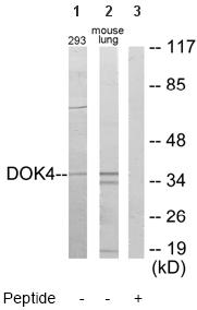 All lanes : Anti-DOK4 antibody (ab64841) at 1/500 dilutionLane 1 : Extracts of 293 cellsLane 2 : Extracts of Mouse lung cellsLane 3 : Extracts of Mouse lung cells with immunising peptide