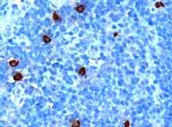 Ab24360 (1ug/ml) staining human DOK5 in human tonsil by immunohistochemistry using paraffin embedded tissue. Microwaved antigen retrieval with citrate buffer pH6, HRP-staining.