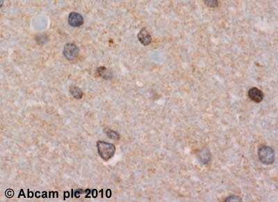 ab40653 (1:500) staining Dopamine Receptor D1 in human cerebellum using an automated system (DAKO Autostainer Plus). Using this protocol there is strong staining of cytoplasmic and membrane regions in the fibrous glial cells.Sections were rehydrated and antigen retrieved with the Dako 3 in 1 AR buffer EDTA pH 9.0 in a DAKO PT link. Slides were peroxidase blocked in 3% H2O2 in methanol for 10 mins. They were then blocked with Dako Protein block for 10 minutes (containing casein 0.25% in PBS) then incubated with primary antibody for 20 min and detected with Dako envision flex amplification kit for 30 minutes. Colorimetric detection was completed with Diaminobenzidine for 5 minutes. Slides were counterstained with Haematoxylin and coverslipped under DePeX. Please note that, for manual staining, optimization of primary antibody concentration and incubation time is recommended. Signal amplification may be required.
