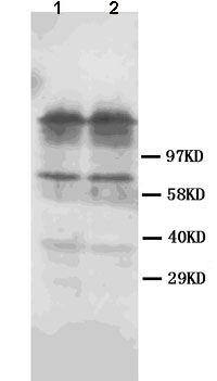 All lanes : Anti-Dopamine Receptor D1 antibody (ab85608) at 1 µg/mlLane 1 : Rat brain tissue lysateLane 2 : Rat brain tissue lysate