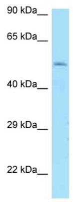 Anti-Dopamine Receptor D1 antibody (ab128295) at 1 µg/ml + 293T cell lysate at 10 µg