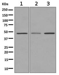 All lanes : Anti-Dopamine Receptor D3 antibody [EPR10148] (ab155098) at 1/1000 dilutionLane 1 : SH-SY5Y lysateLane 2 : Human fetal brain lysateLane 3 : Mouse brain lysateLysates/proteins at 10 µg per lane.SecondaryGoat anti-rabbit HRP at 1/2000 dilution