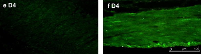 Immunohistochemistry (Formalin/PFA-fixed paraffin-embedded sections) analysis of rat gastric tissue labelling Dopamine Receptor D4 with ab20424 at 1/1000. Dopamine Receptor D4 was not found in the gastric mucosa (e - left) but was observed in the gastric enteric plexus (f - right). Paraffin sections were baked at 60°C for 2 hours, then deparaffinized in xylene for 20 minutes. Slides were rehydrated in descending concentrations of alcohol and transferred from 70% alcohol solution to distilled water for rinsing. Before staining, slides were pretreated with 10 mM citric acid (pH 6.0) at 92–98°C for 10 min and incubated in 10% normal serum and 0.1% Triton X-100 for 30 min. The sections were then incubated with the primary antibody, followed by the appropriate secondary antibody. Sections were washed in PBS and mounted in 90% glycerin PBS.