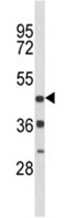 Anti-Dopamine Receptor D4 antibody (ab93398) at 1/100 dilution + Mouse heart tissue lysate at 35 µg