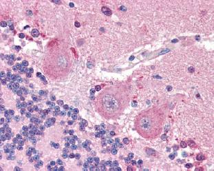 Formalin/PFA-fixed ,paraffin-embedded human cerebellum tissue labelled with ab76068 at 20 µg/ml.