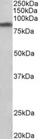 Anti-Dopamine Transporter antibody (ab130140) at 1 µg/ml + Human Substantia nigra lysate (in RIPA buffer) at 35 µgdeveloped using the ECL technique