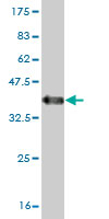 Western blot against tagged recombinant protein immunogen using ab57146 DORFIN antibody at 1ug/ml.