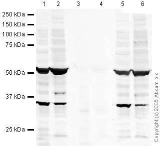 All lanes : Anti-Doublecortin (phospho S28) antibody - Neuronal Marker (ab23544) at 1 µg/mlLane 1 : Mouse Adult Brain Whole Tissue LysateLane 2 : Brain (Mouse) Tissue Lysate - normal tissue, 0 days old (ab7188)Lane 3 : Mouse Adult Brain Whole Tissue Lysate with Mouse Doublecortin (phospho S28) peptide (ab31511) at 1 µg/mlLane 4 : Brain (Mouse) Tissue Lysate - normal tissue, 0 days old (ab7188) with Mouse Doublecortin (phospho S28) peptide (ab31511) at 1 µg/mlLane 5 : Mouse Adult Brain Whole Tissue Lysate with Mouse Doublecortin peptide (ab31512) at 1 µg/mlLane 6 : Brain (Mouse) Tissue Lysate - normal tissue, 0 days old (ab7188) with Mouse Doublecortin peptide (ab31512) at 1 µg/mlLysates/proteins at 20 µg per lane.SecondaryGoat polyclonal to Rabbit IgG (Alexa Fluor® 680) at 1/10000 dilutionPerformed under reducing conditions.