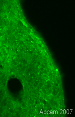 Immunofluorescent staining for Doublecortin (phospho S28) in the rat habenular nucleus using Rabbit polyclonal to Doublecortin (phospho S28). The staining pattern observed with ab23544 appears to be specific, however, the staining is not very strong or contrasted - this might be expected for detection of a modification protein in unstimulated tissue. Protocol details: Rats were intracardially perfused with 4% paraformaldehyde. Whole brain tissue was post-fixed overnight in the same fixative, and cryoprotected in 20% sucrose and frozen in OCT. 30µm coronal sections were cut by cyrostat for use in free floating IHC. Primary antibody ab123544 was incubated overnight at 1/1000 at room temperature. Secondary antibody Alexa fluor 488 1/1000 was incubated for 2 hours at room temperature.