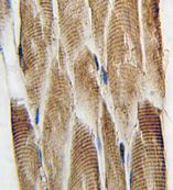 ab75863 at 1/50 dilution staining Doublecortin in human skeletal muscle tissue section by Immunohistochemistry (Formalin/ PFA fixed paraffin-embedded sections). A peroxidase conjugated secondary antibody was used followed by DAB staining.