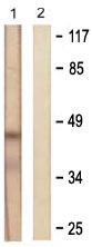 All lanes : Anti-Doublecortin antibody (ab61121) at 1/500 dilutionLane 1 : Extracts from RAW264.7cellsLane 2 : Extracts from RAW264.7cells with immunising Doublecortin peptide at 5 µgLysates/proteins at 5 µg per lane.