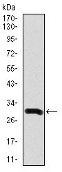 Anti-Doublecortin antibody [2G5] (ab135349) at 1/500 dilution + Recombinant Human Doublecortin protein