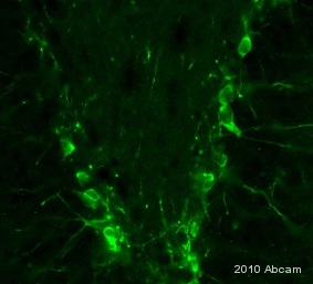 Immunohistochemistical detection of Doublecortin using ab77450 on PFA perfusion-fixed free floating 30um rat brain sections. Primary Antibody diluted 1/1000 and incubated for 18 hours @ 20°C in PBS + 0.3 % Triton X100. Secondary Antibody: Goat anti-rabbit Alexa Fluor® 488 (1/1000). Excellent staining was observed in rat brain dentate gyrus neurons with ab77450.See Abreview