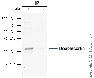 Doublecortin was immunoprecipitated using 0.5mg Rat brain tissue, 5µg of Rabbit polyclonal to Doublecortin and 50µl of protein G magnetic beads (+). No antibody was added to the control (-). The antibody was incubated under agitation with Protein G beads for 10min, Rat brain tissue lysate diluted in RIPA buffer was added to each sample and incubated for a further 10min under agitation.Proteins were eluted by addition of 40µl SDS loading buffer and incubated for 10min at 70oC; 10µl of each sample was separated on a SDS PAGE gel, transferred to a nitrocellulose membrane, blocked with 5% BSA and probed with ab23542.Secondary: Mouse monoclonal [SB62a] Secondary Antibody to Rabbit IgG light chain (HRP) (ab99697).Band: 50kDa; Doublecortin