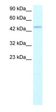 Anti-DP2 antibody (ab26260) at 1.25 µg/ml + Jurkat cell lysateSecondaryHRP conjugated anti-Rabbit IgG diluted 1/50000 - 1/100000 