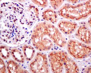 Immunohistochemical analysis of paraffin-embedded, formalin-fixed Human kidney tissue, labelling DPF2 using ab134942 at a 1/100 dilution.