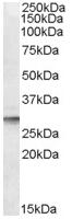 Anti-DPM1 antibody (ab77541) at 0.1 µg/ml + Human liver lysate in RIPA buffer at 35 µg