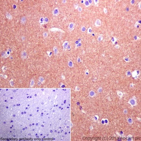 Immunohistochemical analysis of paraffin-embedded Human cerebral cortex tissue labeling DPP6 with ab198506 at 1/500 dilution followed by Goat Anti-Rabbit IgG H&L (HRP) (ab97051) at 1/500 dilution. Cell membrane and cytoplasm staining of Human cerebral cortex tissue is observed. Counter stained with Hematoxylin.Secondary antibody only control: Used PBS instead of primary antibody, secondary antibody is Goat Anti-Rabbit IgG H&L (HRP) (ab97051) at 1/500 dilution.
