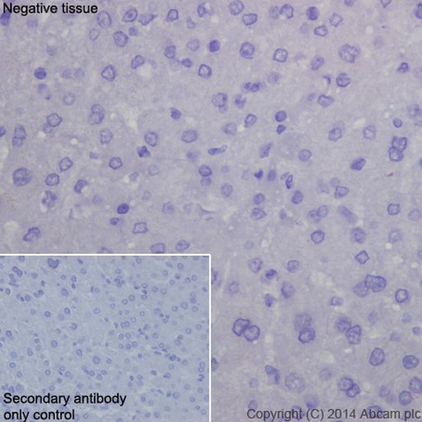 Immunohistochemical analysis of paraffin-embedded Human liver tissue labeling DPP6 with ab198506 at 1/500 dilution followed by Goat Anti-Rabbit IgG H&L (HRP) (ab97051) at 1/500 dilution. No staining of Human liver tissue is observed. Counter stained with Hematoxylin.Secondary antibody only control: Used PBS instead of primary antibody, secondary antibody is Goat Anti-Rabbit IgG H&L (HRP) (ab97051) at 1/500 dilution.
