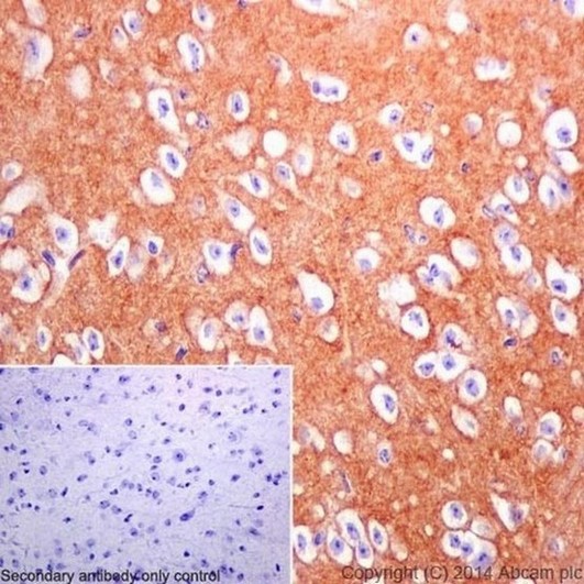 Immunohistochemical analysis of paraffin-embedded Mouse cerebral cortex tissue labeling DPP6 with ab198506 at 1/500 dilution followed by Goat Anti-Rabbit IgG H&L (HRP) (ab97051) at 1/500 dilution. Cell membrane and cytoplasm staining of Mouse cerebral cortex tissue is observed. Counter stained with Hematoxylin.Secondary antibody only control: Used PBS instead of primary antibody, secondary antibody is Goat Anti-Rabbit IgG H&L (HRP) (ab97051) at 1/500 dilution.