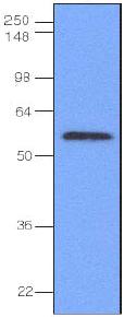 Anti-IRF3 antibody [3F10] (ab63468) at 1/1000 dilution + HeLa cell lysate at 40 µgSecondaryGoat anti-mouse secondary antibody conjugated to HRPdeveloped using the ECL technique