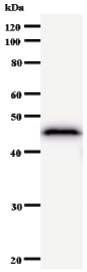Anti-Iroquois homeobox protein 3 antibody [IRX33B4C1] (ab50773) + Recombinant IRX3 protein
