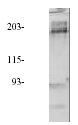 IP: 3T3 cell lysate immunoprecipitated with Anti-IRS-2 (pSER731) (ab3690)