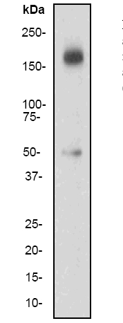 Anti-IRS2 antibody [EP903Y] (ab46811) at 1/100000 dilution + 293 cell lysate at 10ug/lane, plus insulin SecondaryGoat-anti rabbit, HRP labelled, at 1/2000 dilution