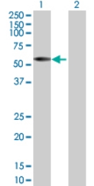 All lanes : Anti-IRX2 antibody (ab72975) at 1/500 dilutionLane 1 : IRX2 transfected 293T cell lysateLane 2 : Non-transfected 293T cell lysateLysates/proteins at 25 µg per lane.SecondaryGoat Anti-Mouse IgG (H&L)-HRP Conjugate at 1/2500 dilution