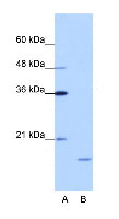 Anti-ISG20 antibody (ab50834) at 1.25 µg/ml + Daudi Cell Lysate at 10 µgSecondaryHRP conjugated anti-Rabbit IgG at 50000
