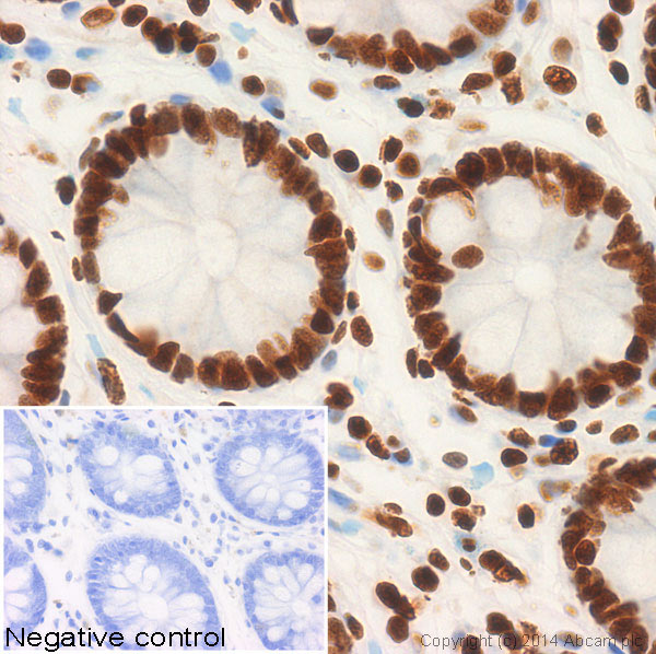 IHC image of ab58548 staining Histone H2A (acetyl K5) in human colon formalin fixed paraffin embedded tissue sections, performed on a Leica Bond. The section was pre-treated using heat mediated antigen retrieval with sodium citrate buffer (pH6, epitope retrieval solution 1) for 20 mins. The section was then incubated with ab58548, 1µg/ml, for 15 mins at room temperature and detected using an HRP conjugated compact polymer system. DAB was used as the chromogen. The section was then counterstained with haematoxylin and mounted with DPX. No primary antibody was used in the negative control (shown on the inset).For other IHC staining systems (automated and non-automated) customers should optimize variable parameters such as antigen retrieval conditions, primary antibody concentration and antibody incubation times.