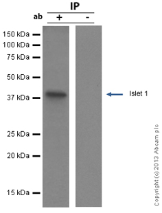 Jurkat whole cell lysate was for this immunoprecipitation experiment.