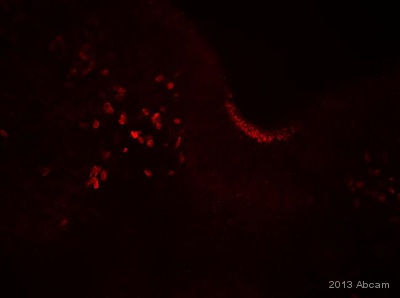 IHC-Fr image of anti-Islet 1 staining with ab109517 on tissue sections from chicken hindbrain. The sections were blocked with 3% BSA for 1 hour at 4°C, before incubation with ab109517 (1/1000 dilution) for 16 hours at 4°C. The secondary was an Alexa-Fluor 568 conjugated goat anti-rabbit polyclonal, used at a 1/1000 dilution.See Abreview